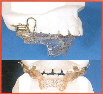 Propulsore mandibolare 4L