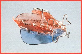 Bionator modificato n2
