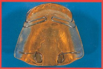 Attivatore di Harvold e Woodside di III classe