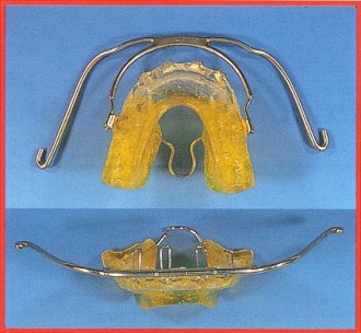 Attivatore di Teuscher
