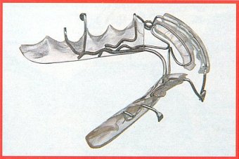 Spring Aligner inferiore n3