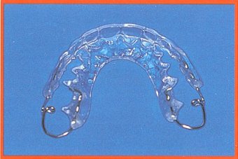Memory retainer
