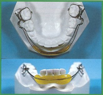 Lip-Bumper