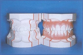 Set-up diagnostico