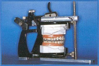 Posizionatori con sistema Wafer Bite (dr.Per Varde)