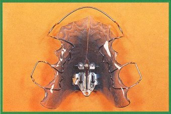 Dispositivo con vite ad apertura anteriore