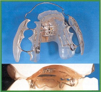 Dispositivo con vallo di avanzamento mobile inferiore