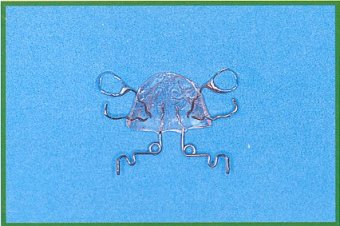 Pendulum disegnato dal dr. Hilgers