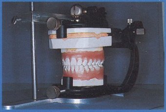 Set-up con Wafer Bite